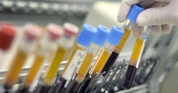 علماء يقولون إنهم اقتربوا من التوصل لتحليل دم للإرهاق المزمن - صحيفة الجامعة