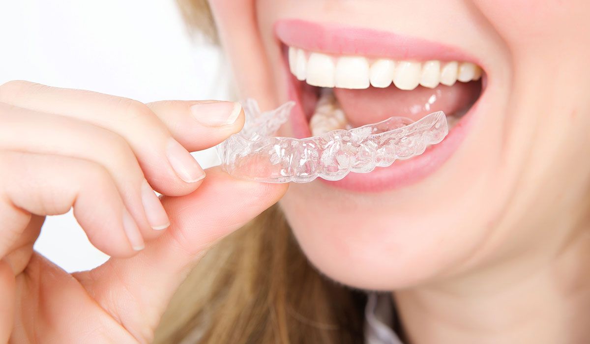 تعرف على أحدث تقنيات تقويم الأسنان.. القالب الشفاف - صحيفة الجامعة