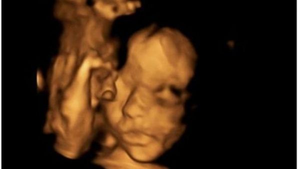 أطباء يجرون عملية جراحية بالعمود الفقري لجنين في رحم أمه - صحيفة الجامعة